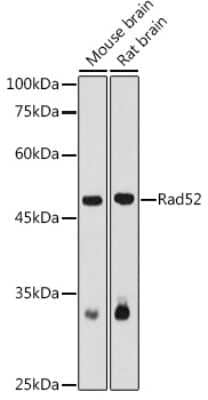 Western Blot: RAD52 AntibodyBSA Free [NBP2-95195]